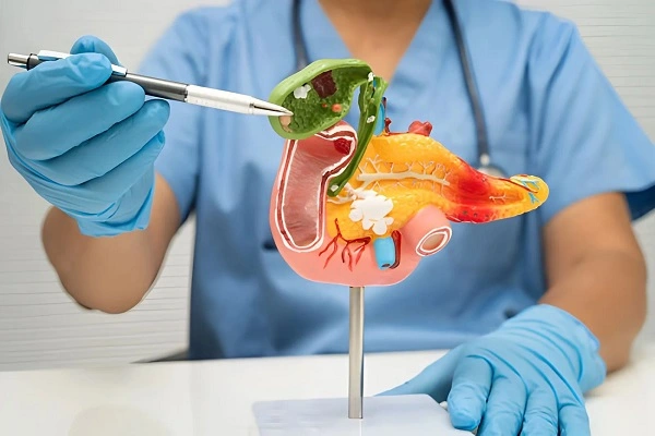 Best Gallbladder Stone Surgeon in Mahim, Mumbai